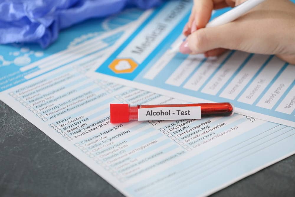 Image is of a blood sample labeled alcohol test beside medical testing forms, concept of blood alcohol evidence in a Cocoa Beach DUI case.